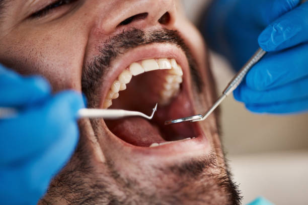 Best Emergency Dental Services for Seniors in Knox, IN